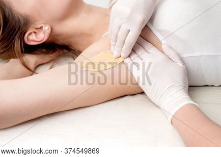 Hand Of Cosmetologist Applying Wax Paste On Armpit. Depilation Or Epilation Female Armpit With Liqui