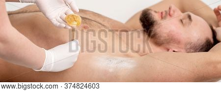 Depilation And Epilation Male Armpit With Liquid Sugar Paste By Spatula. Hand Of Cosmetologist Apply
