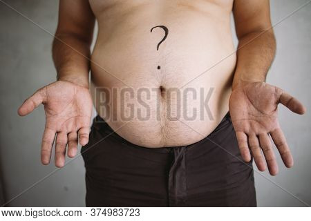 Overweight Man With Excess Belly Fat, Close Up. Weight Loss, Diet And Health Care Concept