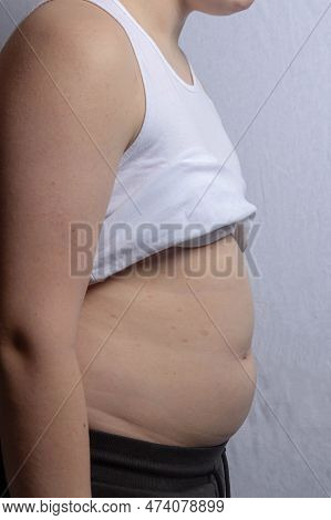 An Overweight Shirtless Caucasian Teenage Boy Wearing A Sleevless Top Showing His Stomach