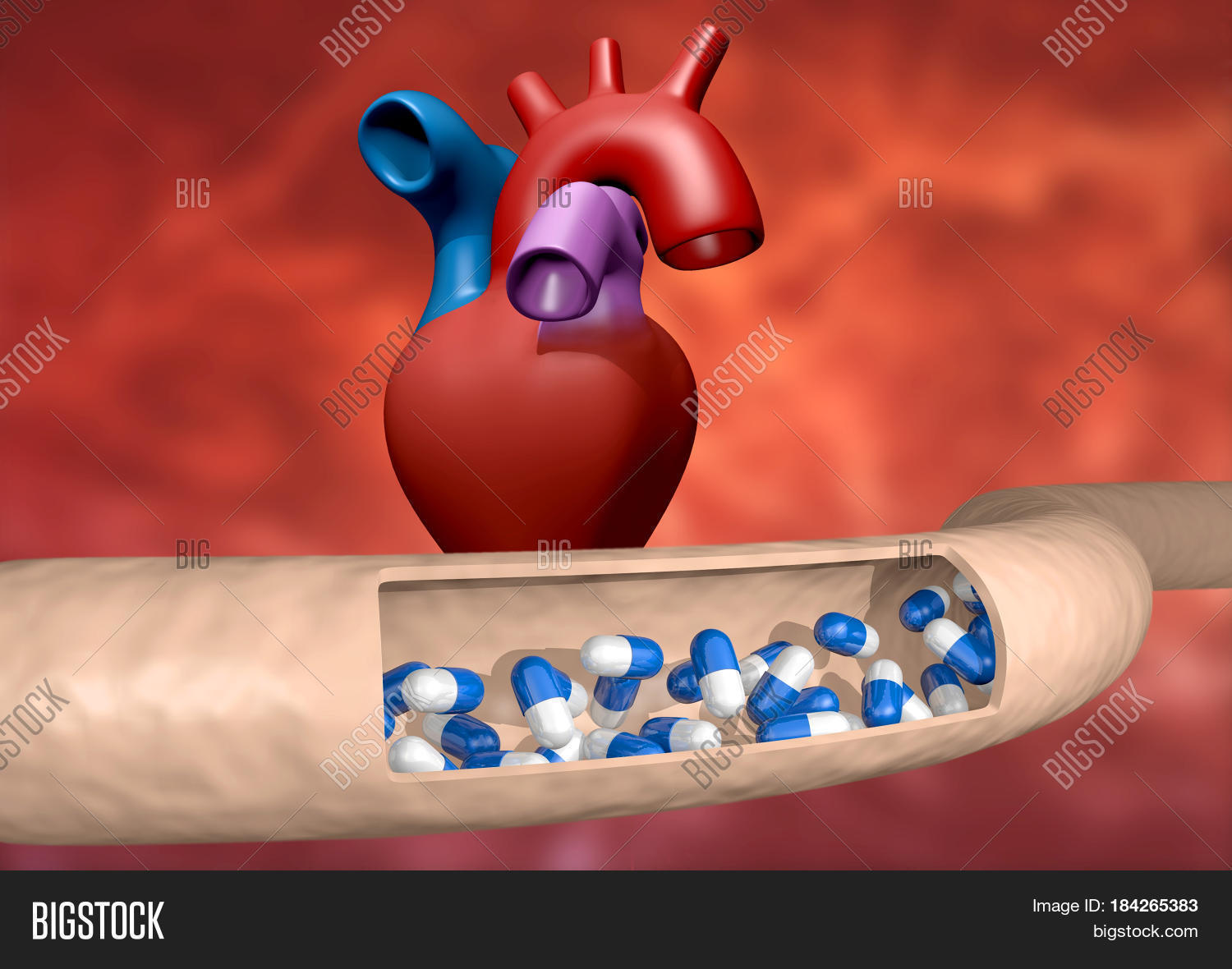 Cut Artery Leading Image & Photo (Free Trial) Bigstock