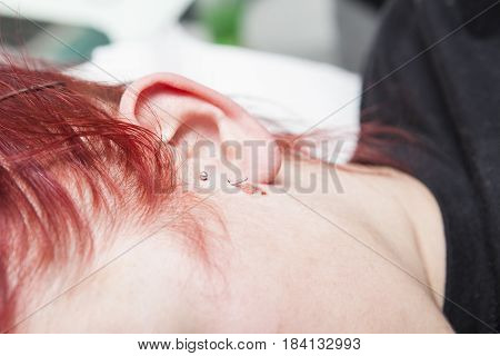 Young red-haired girl with piercing jewel just after to be pierced on ear skin. Tragus type