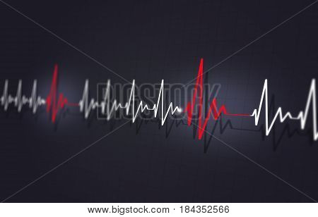 Heart Disease Arrythmia