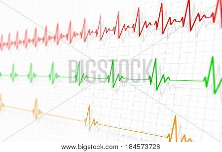 Differents Of Heartbeatings