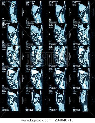 Mri Scan Image Of Chest And Abdomen. Medical Diagnostic