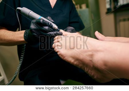 Podology, Treatment Of The Affected Areas Of The Feet, Medical Office, Pedicure
