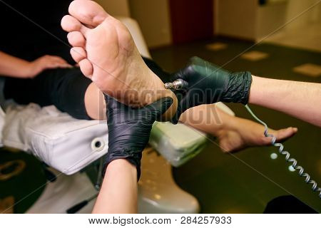 Podology, Treatment Of The Affected Areas Of The Feet, Medical Office, Pedicure