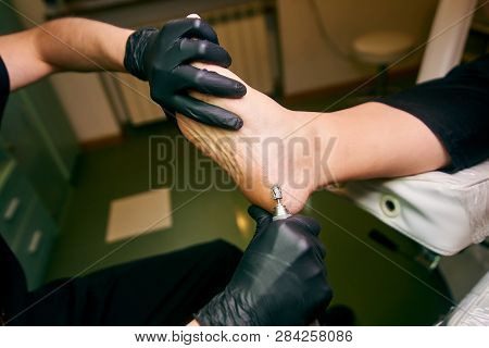 Podology, Treatment Of The Affected Areas Of The Feet, Medical Office, Pedicure