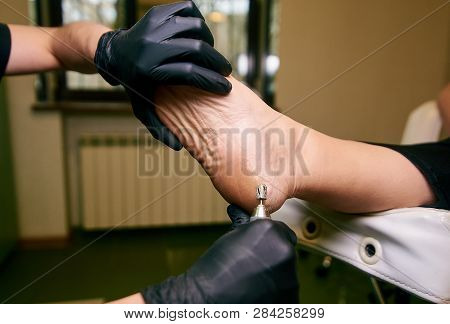 Podology, Treatment Of The Affected Areas Of The Feet, Medical Office, Pedicure