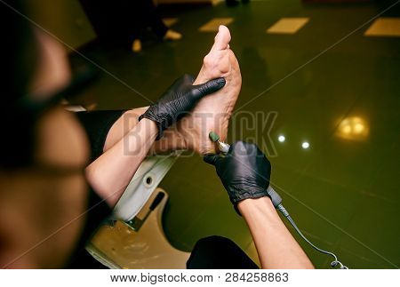 Podology, Treatment Of The Affected Areas Of The Feet, Medical Office, Pedicure