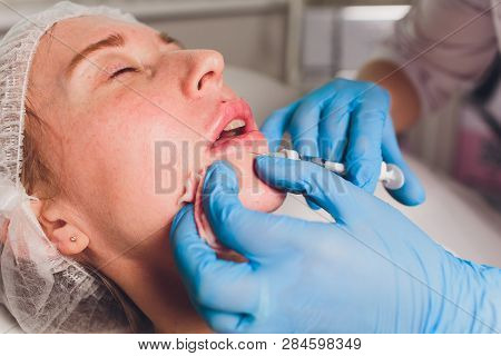 The Doctor Cosmetologist Makes Lip Augmentation Procedure Of A Beautiful Woman In A Beauty Salon.cos