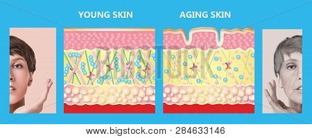 The Younger Skin And Aging Skin. Elastin And Collagen. A Diagram Of Young And Old Face Showing The D