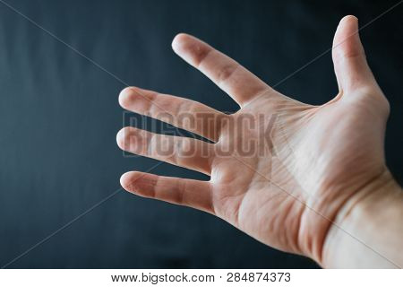 Adult Hand With Raynaud's Syndrome - Phenomenon. Close Up Hand With Fingers On Dark Background With 