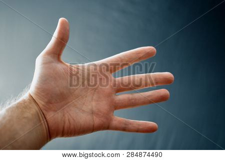 Adult Hand With Raynaud's Syndrome - Phenomenon. Close Up Hand With Fingers On Dark Background With 