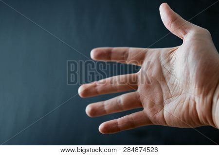 Adult Hand With Raynaud's Syndrome - Phenomenon. Close Up Hand With Fingers On Dark Background With 