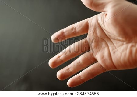 Adult Hand With Raynaud's Syndrome - Phenomenon. Close Up Hand With Fingers On Dark Background With 