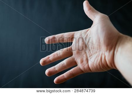 Adult Hand With Raynaud's Syndrome - Phenomenon. Close Up Hand With Fingers On Dark Background With 