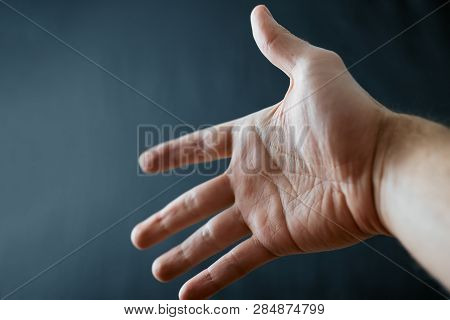 Adult Hand With Raynaud's Syndrome - Phenomenon. Close Up Hand With Fingers On Dark Background With 