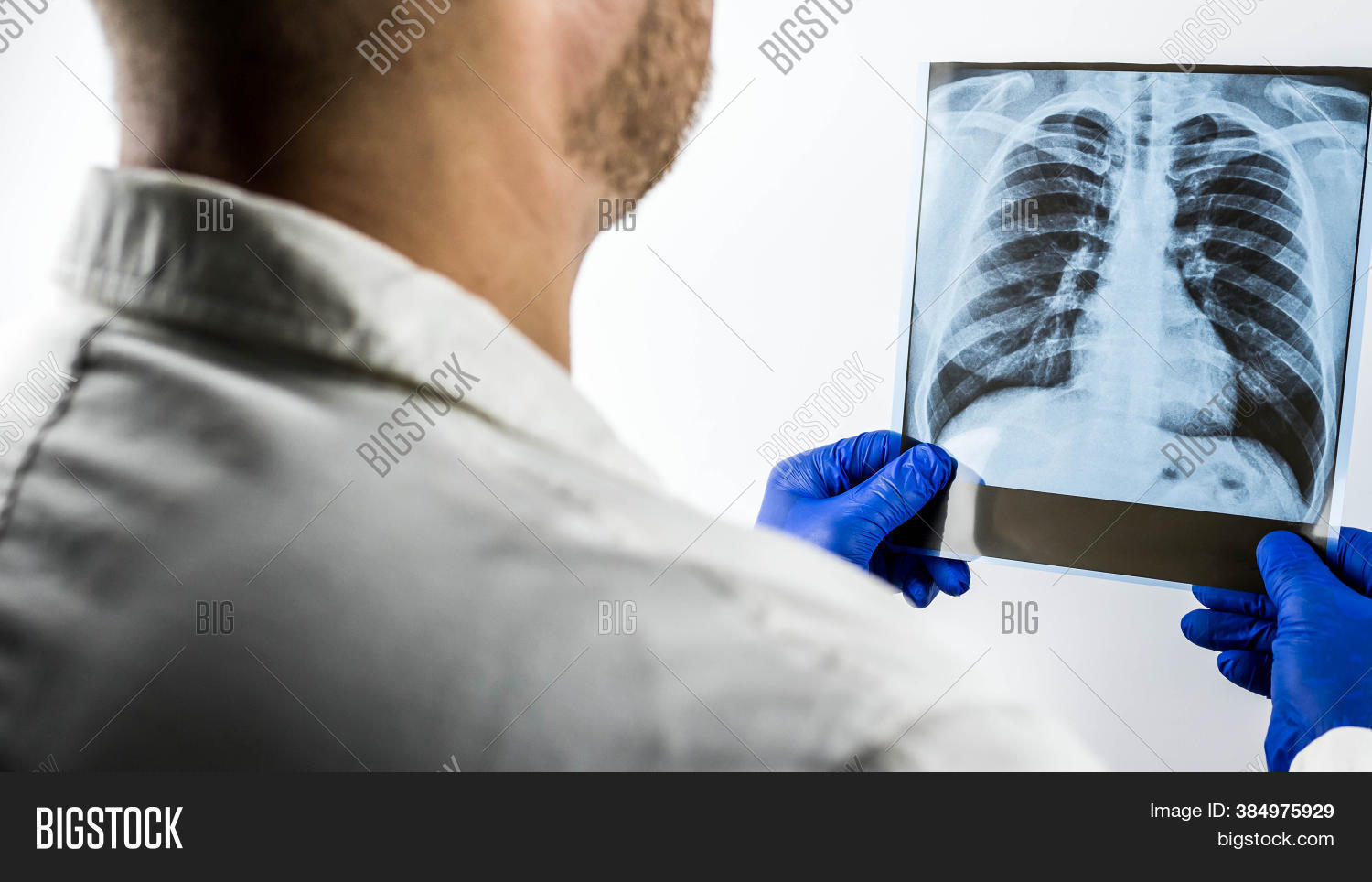 Chest Xray,doctor Image & Photo (Free Trial) Bigstock