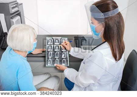 Pulmonologist Showing An Elderly Patient A Ct Scan Of Her Lungs. Pneumonia, Coronavirus, Lung Diseas
