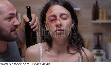 Bruised Woman Looking At The Room While Drunk Husband Screams In The Background. Traumatised Abused 