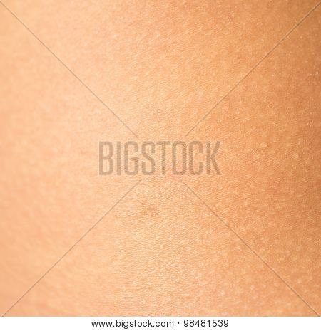 healthy skin