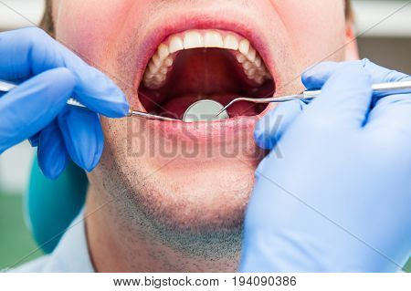 Close-up of male patient with open mouth during oral checkup at the dentist. Healthcare Dentist concept. Selective focus.