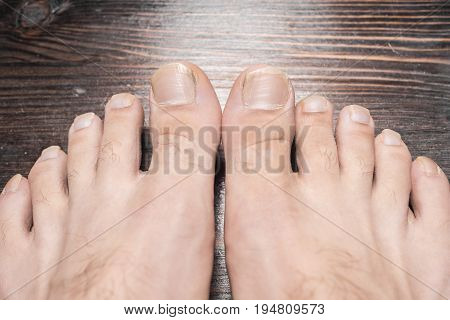 Long nails on the legs of a man on a wooden background