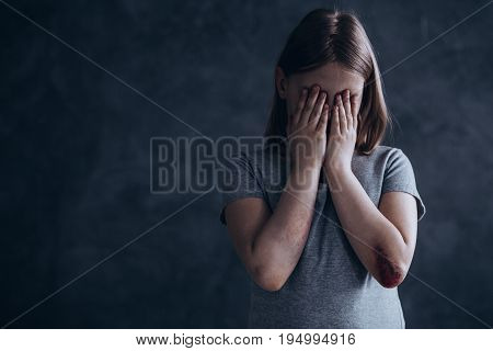 Little girl with bruises covering face with her hands