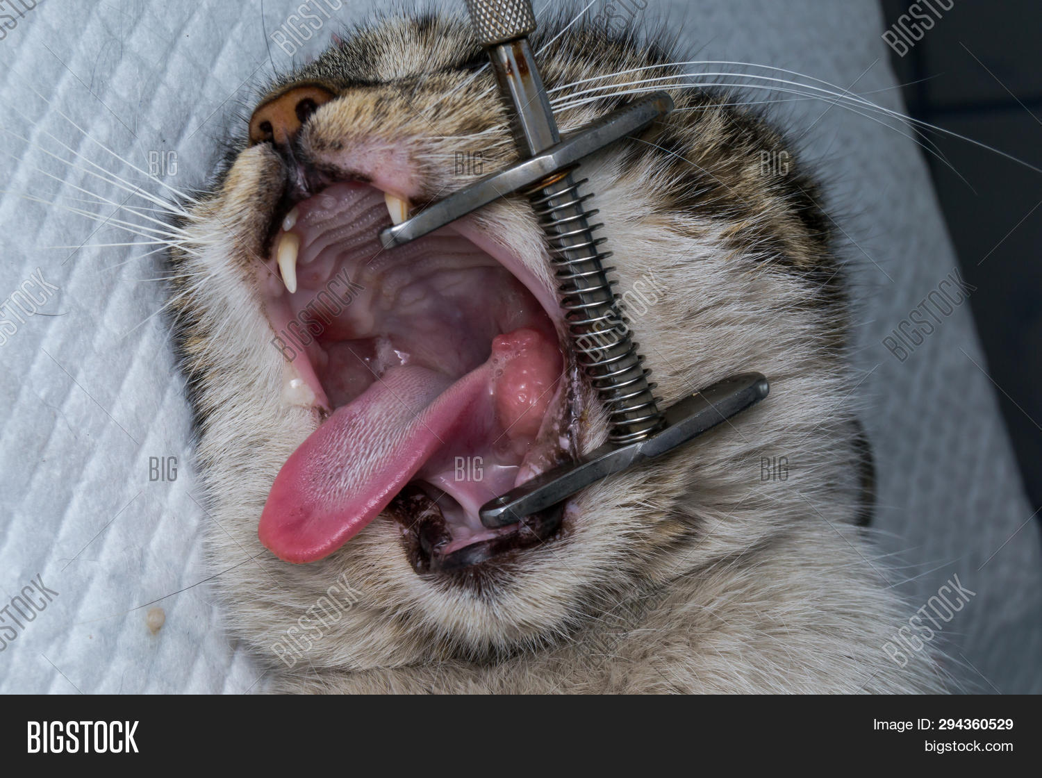 Eosinophilic Granuloma Image & Photo (Free Trial) Bigstock