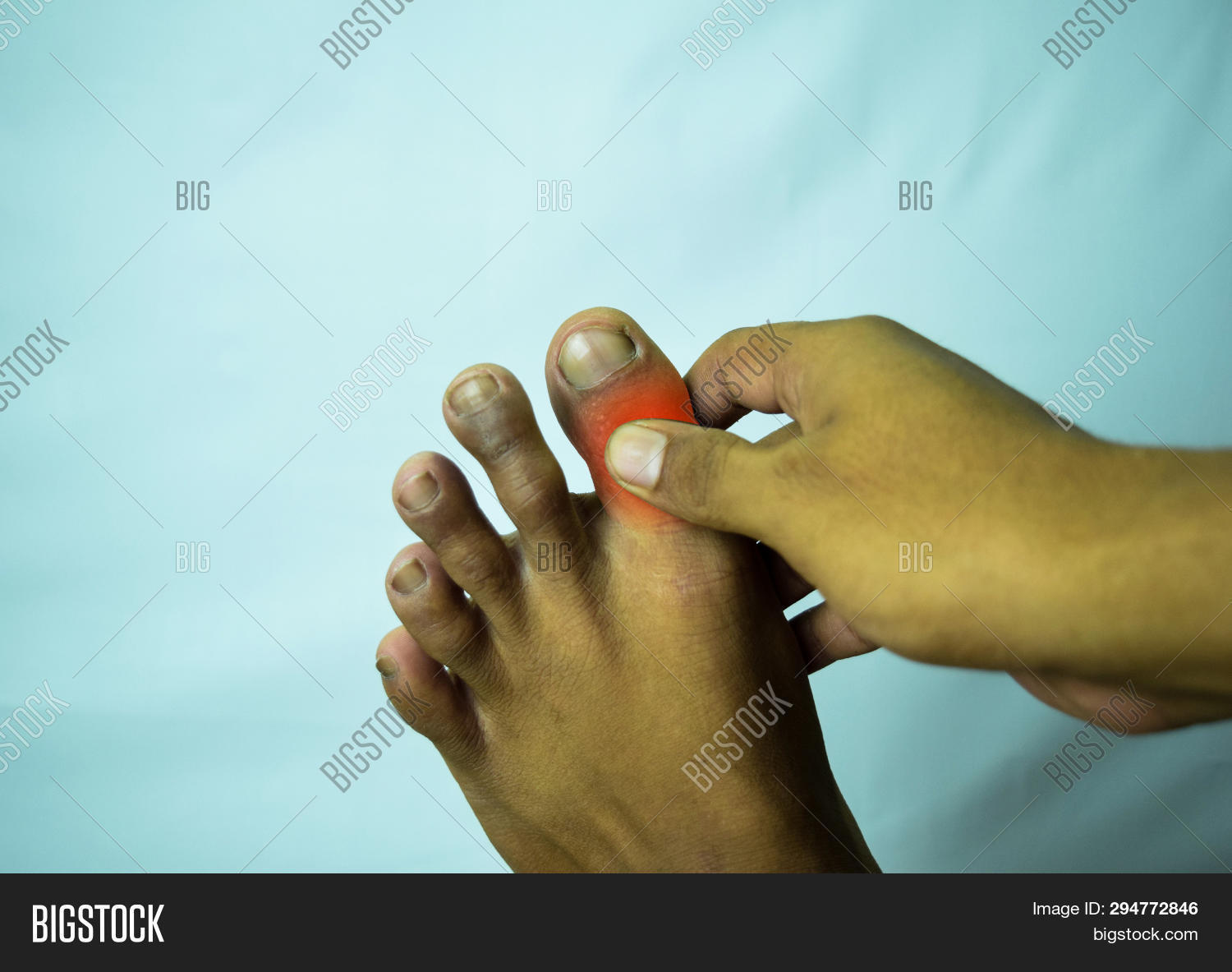 Pain Joint Big Toe Can Image & Photo (Free Trial) Bigstock