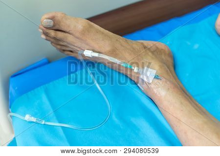 Patient With Saline Intravenous In The Hospital