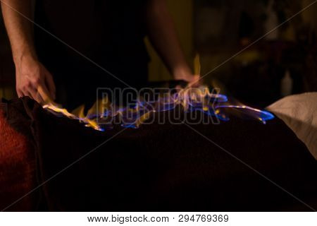 Chinese Fire Massage - Huo Liao Therapy. Traditional Chinese Medicine, Fire Treatment And Bodycare C