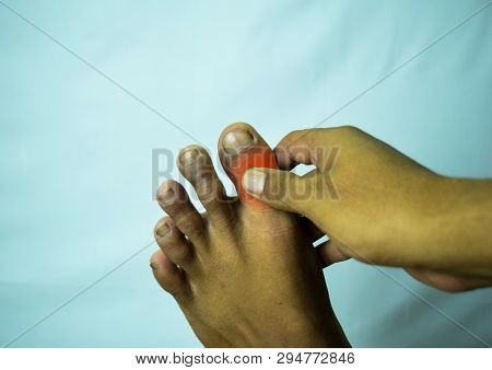 Pain In The Joint Of Big Toe Can Be Discouraging