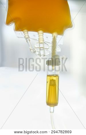 Transfusion Of Fresh Frozen Plazma (ffp), Bag On Stand