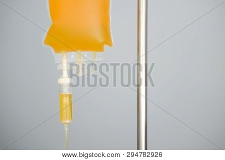 Transfusion Of Fresh Frozen Plazma (ffp), Bag On Stand