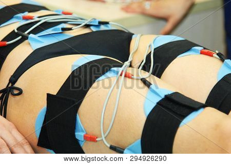 Myostimulation. Hardware Cosmetology. Body Care. Non Surgical Body Sculpting. Anti-cellulite And Ant