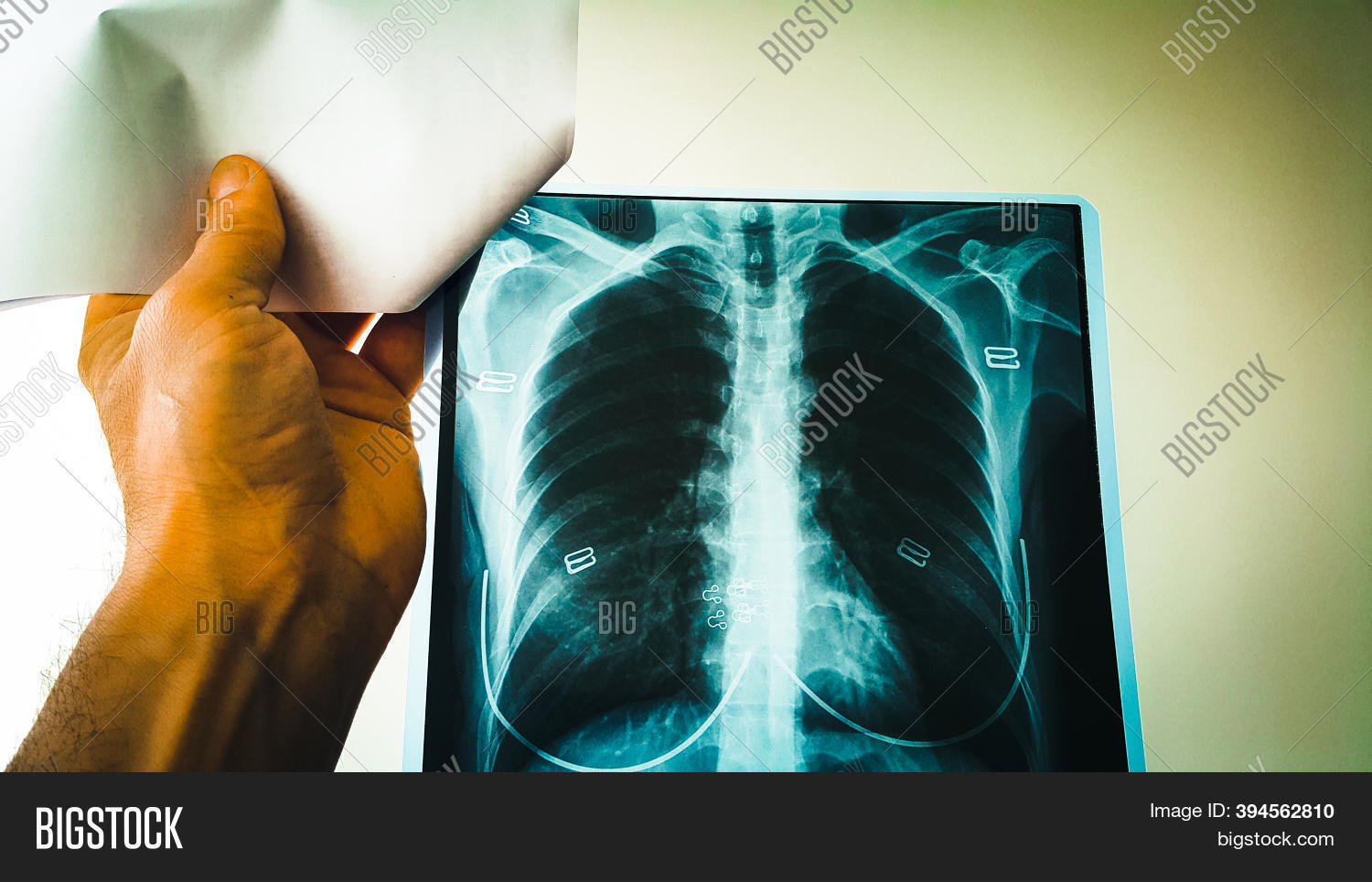 Doctor Checks Xray Image & Photo (Free Trial) Bigstock