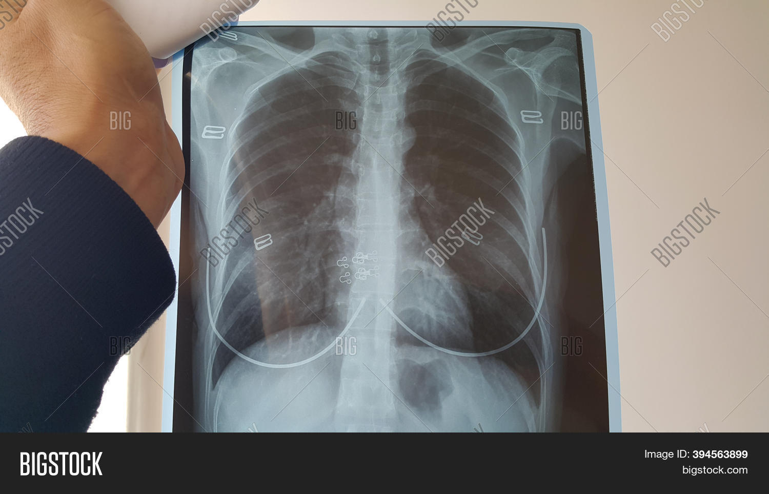 Doctor Checks Xray Image & Photo (Free Trial) Bigstock