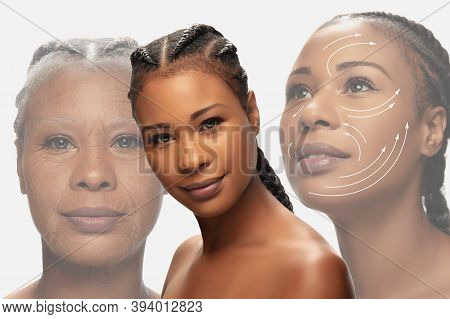 Comparison. Portrait Of Beautiful African Woman With Problem And Clean Skin, Aging And Youth Concept