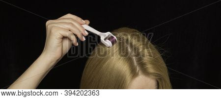 Women's Hair And Mesoroller In Hand On A Black Background. Care For The Scalp, Healthy Hair.