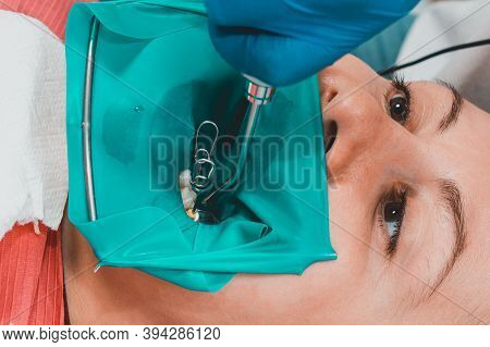 A Patient At A Dentists Appointment, A Doctor Uses A Rubber Dam To Treat Teeth, Disinfects A Tooth F
