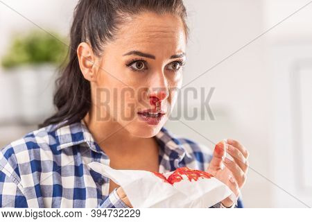 Woman Find Out Her Nose Is Bleeding After Sneezing Into A Tissue.