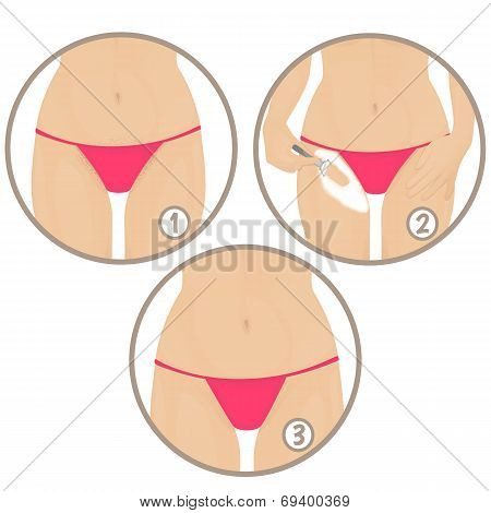 hair removal
