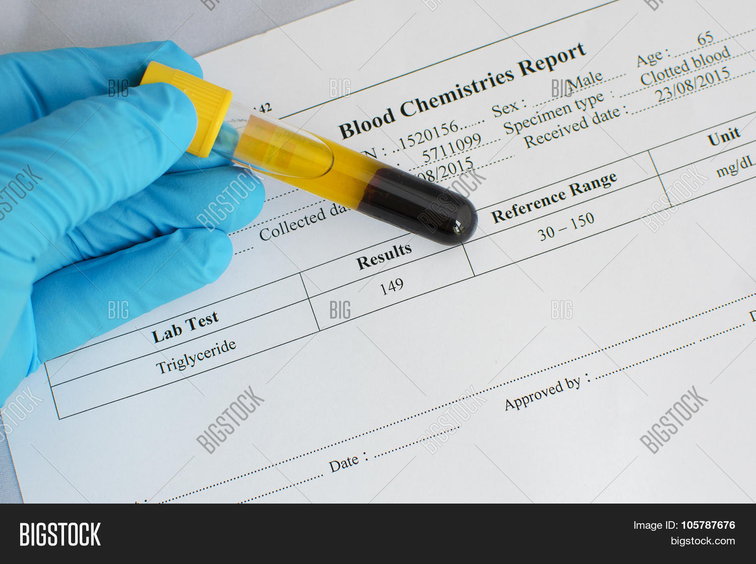 Normal Triglyceride Image & Photo (Free Trial) Bigstock