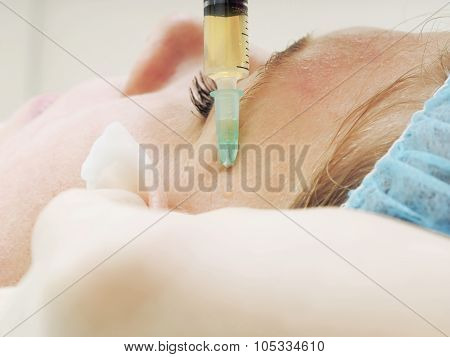 Cosmetology procedure mesoteraphy. Rejuvenation revitalization, skin nutrition, wrinkle reduction. D
