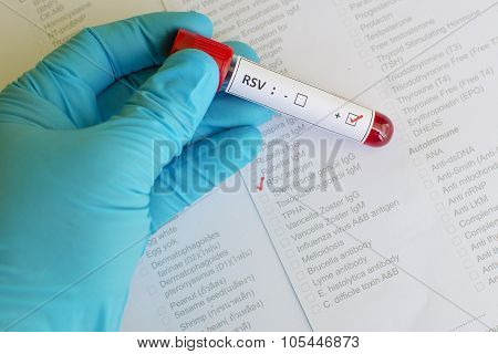 Respiratory syncytial virus (RSV)