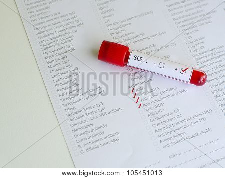 Systemic lupus erythematosus (SLE) positive
