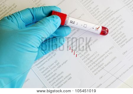 Systemic lupus erythematosus (SLE) positive