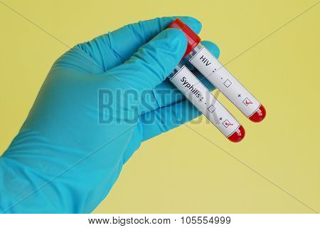 Sexually transmitted diseases